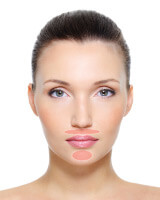Ästhetisch-Plastische Chirurgie für Lippenfalten 